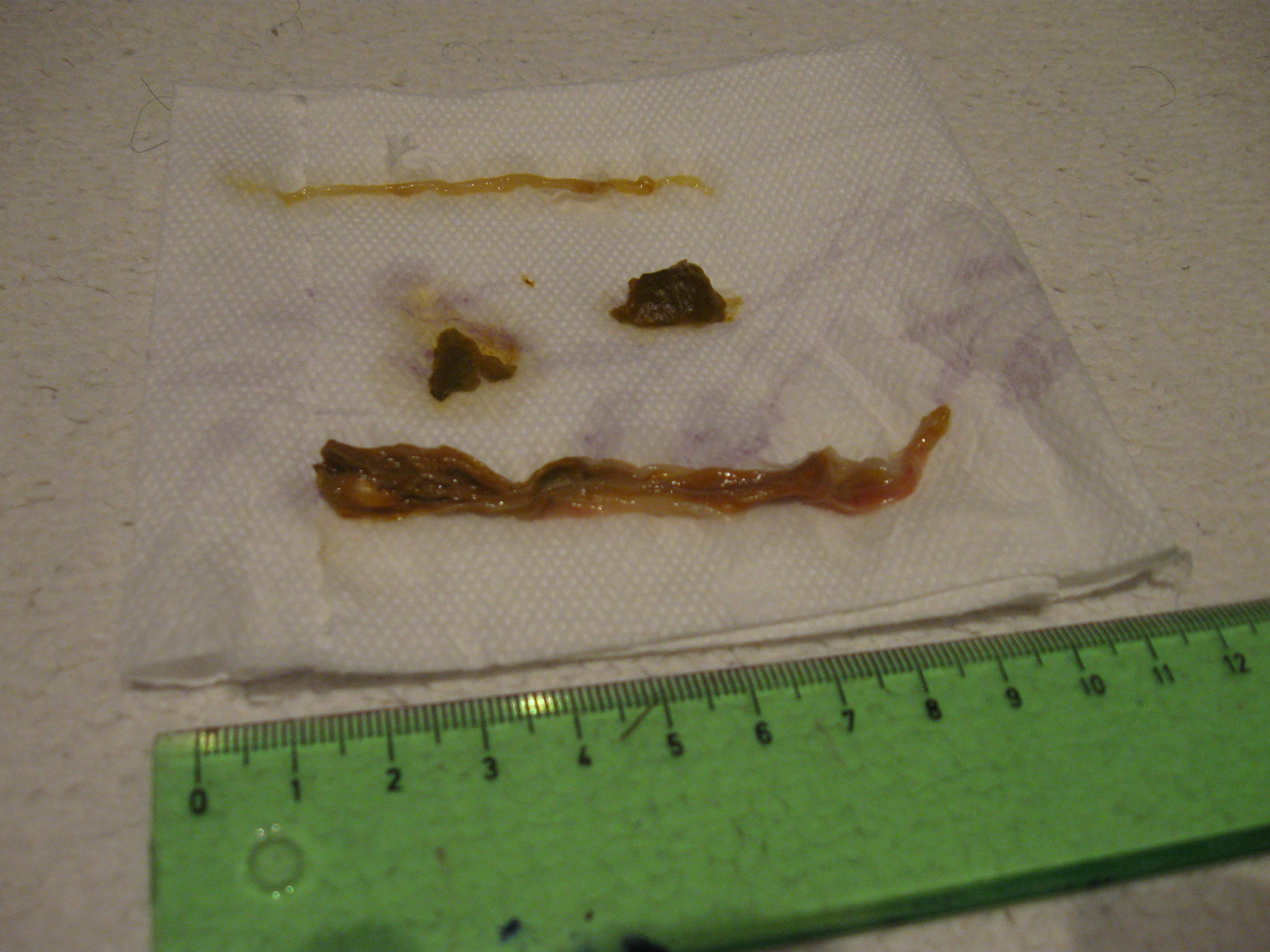 Ropeworm od klientky po plasmování v Medicnatur